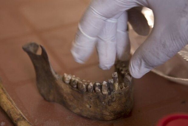 Вчені виростили зі свинячого жиру кістку щелепи