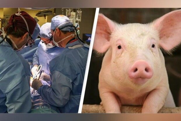 Людині вперше вдало пересадили нирку від… свині