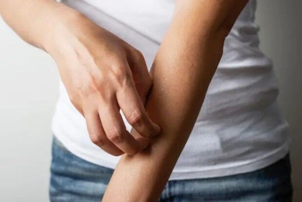 На Волині зареєстровано випадок підшкірного дирофіляріозу