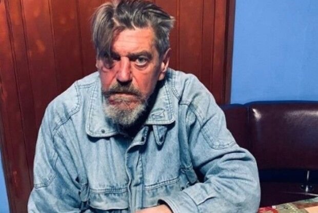 В українському притулку прихистили колишнього учасника улюбленого гурту Путіна