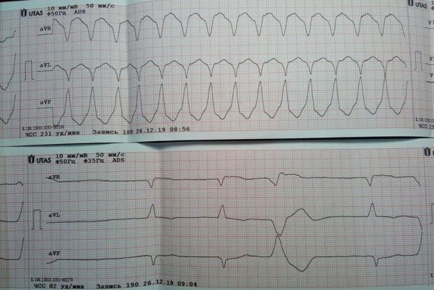 У Любомлі фельдшер та водій швидкої врятували життя важкохворому пацієнту