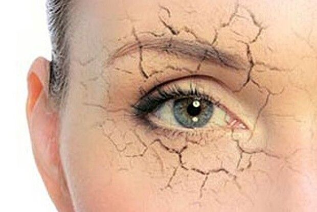 Бачити світ може заважати хвороба «сухого ока»