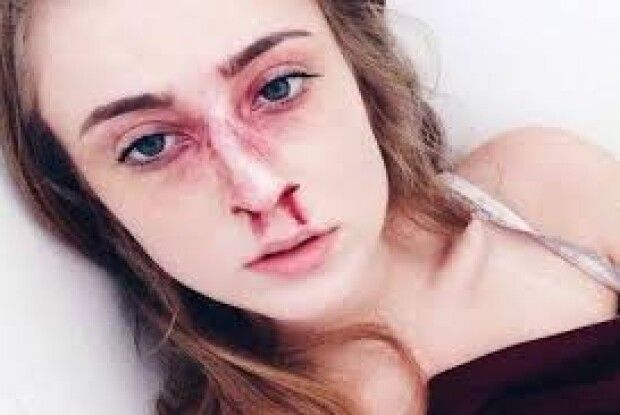 За зламаний ніс дочки волинянин відпрацює 160 годин громадських робіт