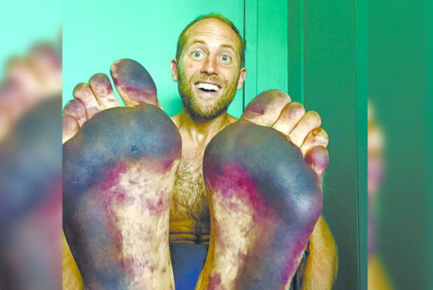 Чоловік уже 12 років ходить лише босоніж