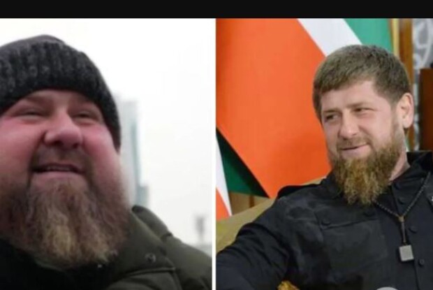 Набрав вагу і набрякає: у кадирова почалися проблеми зі здоров’ям