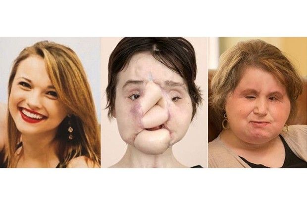 Через нещасливе кохання вистрілила з рушниці собі в голову…