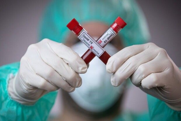 Шок: лікарні переповнені, у картки людям записують будь-які діагнози, крім коронавірусу