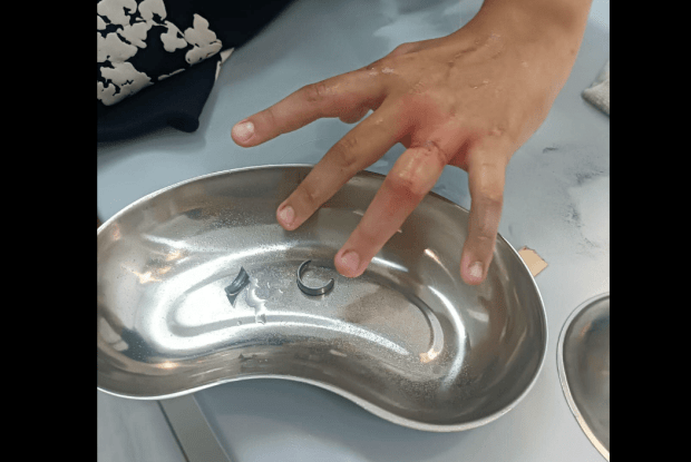 Рятувальники на Волині надали допомогу 12-річному хлопчику