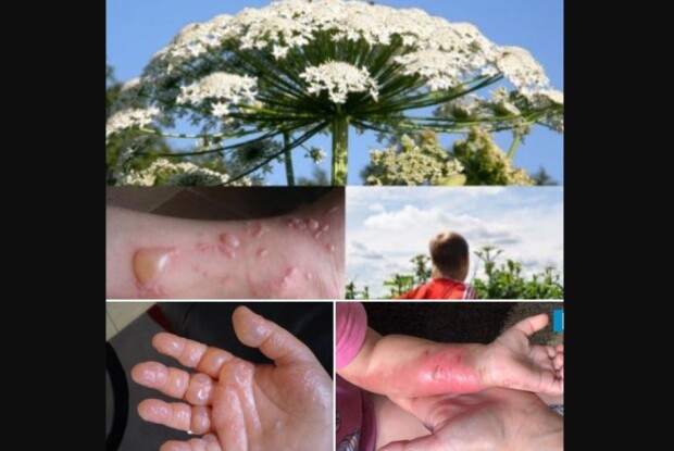 Невже вулиці Рівного обприскують хімією? (Відео)