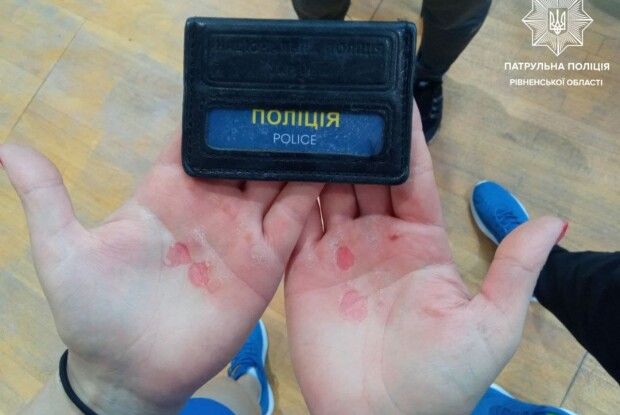 Патрульна із Сарн ціною кров'яних мозолів виборола «золото» на Чемпіонаті України з гирьового спорту (Фото)