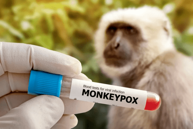 Спалах mpox – першого хворого виявили у Швеції