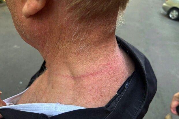 Зірвав з пенсіонера ланцюжок: у Рівному грабіжнику світить до 10 років за ґратами