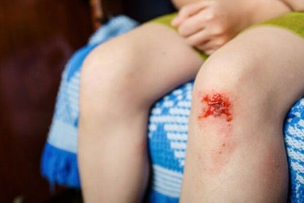 «Не бійся, я з тобою»