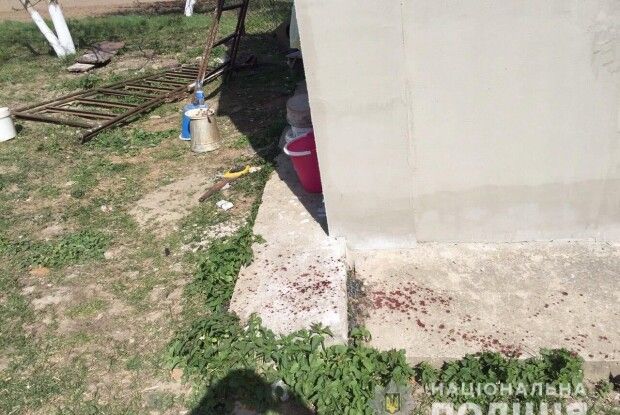 Через необережність зі зброєю позбувся пальців