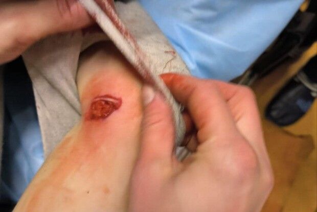 Затримали 20-річного чоловіка, який кинув у рівнян гранату (Фото)