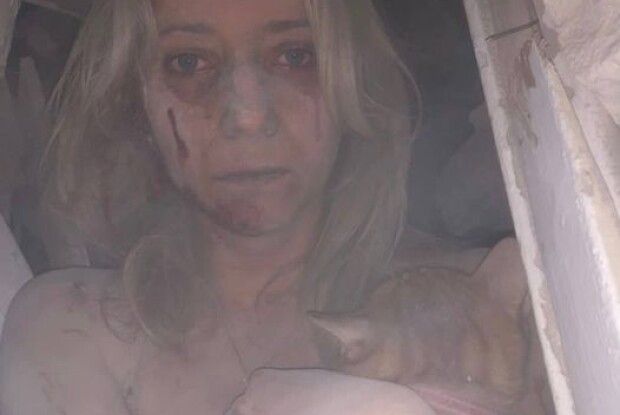 «Це фото має облетіти світ»: у соцмережі діляться світлиною, на якій врятована дівчина із Запоріжжя тримає кота