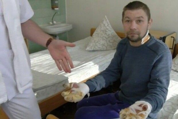 Йшов руками по снігу: волинянин обморозив долоні та пальці (Відео)