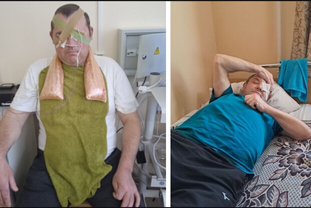 18 людей повністю або частково осліпли після ін’єкції в очі