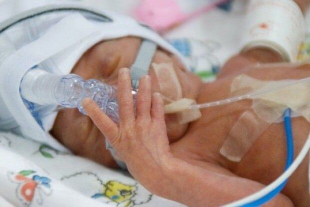 Від кашлюку померла одномісячна дитина