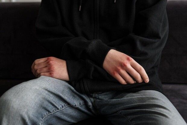 Побиття на Білому озері Рівненщини: жінка померла, директор РАЕС відреагував на публікації про нього і сина-підозрюваного (Відео)