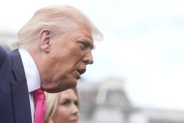  У Трампа знайшли венозну недостатність 