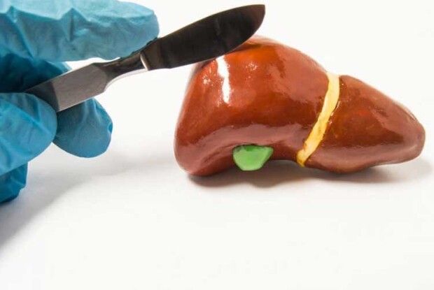 Хірург ставив свої «автографи» на печінках пацієнтів. Його позбавили ліцензії