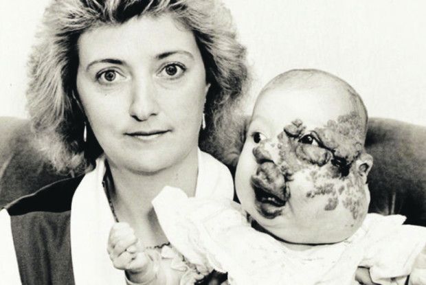 Дівчина пережила  18 операцій  і сама стала хірургом