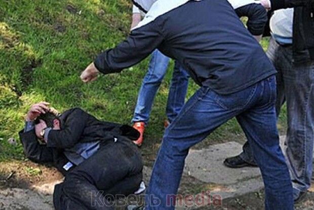 На Ковельщині стоматолог побив чоловіка