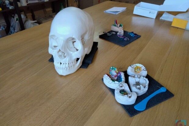 Як у Луцьку працює ортодонтична лабораторія з Харкова