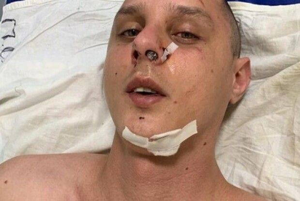 У Києві жорстоко побили автора пісень гурту KAZKA 