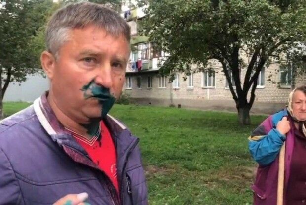 У Житомирі раптово позеленів депутат від «Опоблоку»