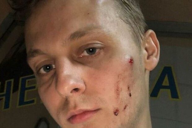 У Києві побили сина депутата Шуфрича