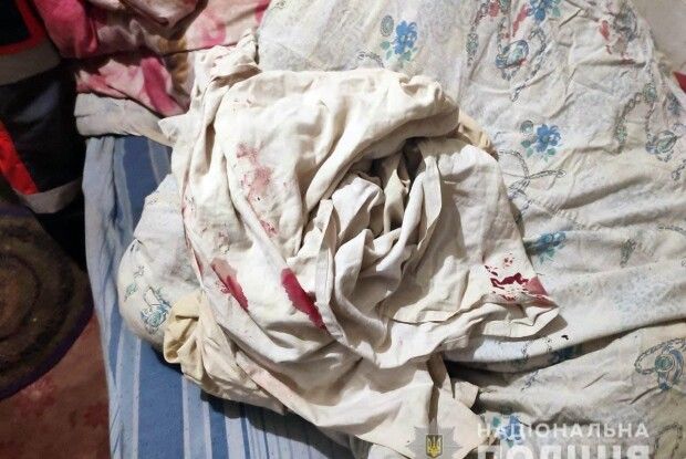 На Рівненщині чоловік побив 91-річну матір коцюбою (Фото)