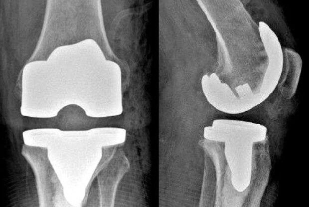 Волинські хірурги провели унікальну операцію