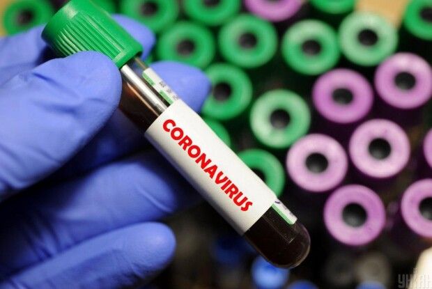 За вчорашній день на Горохівщині  виявлено 7 випадків COVID-19
