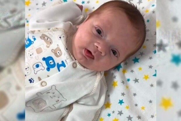 Медики виходили малюка, який народився з вагою 580 грамів