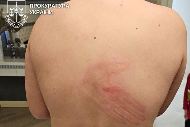 Босоніж на морозі: на Рівненщині судили батька-тирана