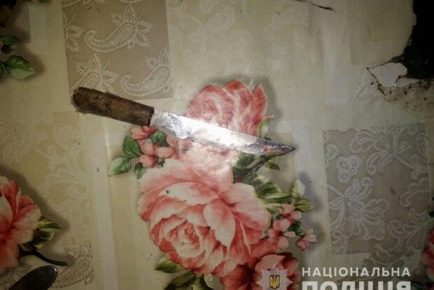 На Рівненщині батько «виховував» сина ножем (Фото 18+)