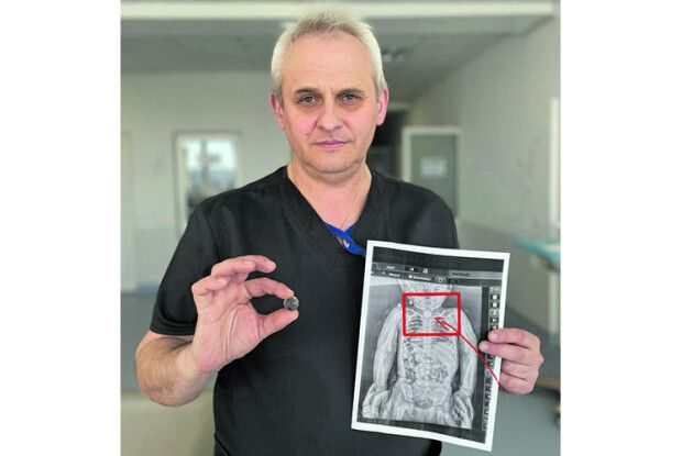 2-річна Софійка місяцями жила  з батарейкою у стравоході