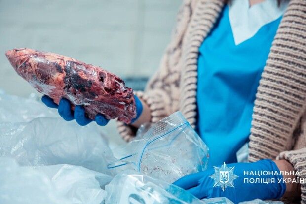 Як на Буковині лікарі заробляли на тілах померлих