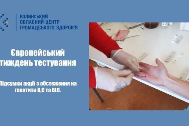У Луцьку під час безкоштовного обстеження у 8-ми людей виявили гепатит С