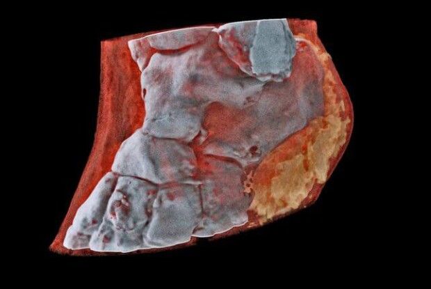 У Новій Зеландії створили рентген, який робить кольорові тривимірні зображення