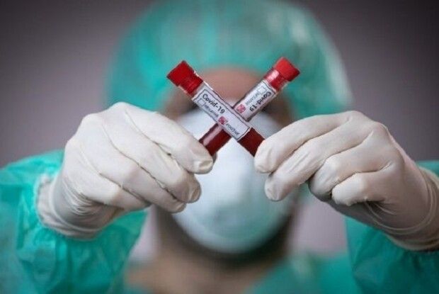 В Україні смертність від Covid-19 менша, ніж в Західній Європі