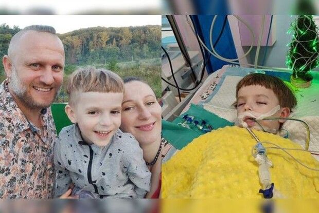 5-річний хлопчик впав у кому після видалення зубів