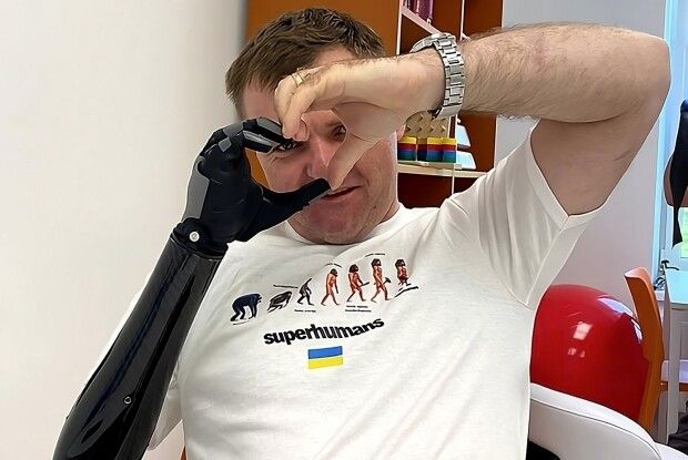 Військовому з Луцька за допомогою 3D-друку провели унікальну операцію з реконструкції обличчя (Фото)
