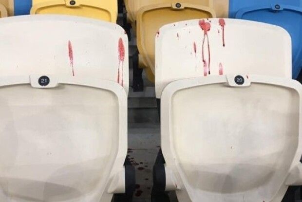 Поліція відкрила справу через бійку фанатів на «Олімпійському»