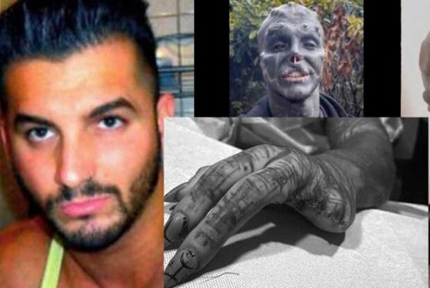 Чоловік відрізав собі пальці, щоб стати «чорним інопланетянином»