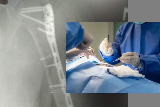 Володимирські медики провели успішну травматологічну операцію