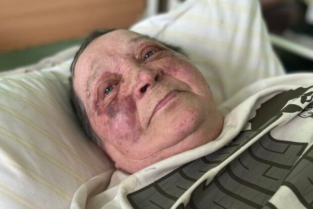 Зламали хребет, бо не хотіла віддавати окупантам український паспорт