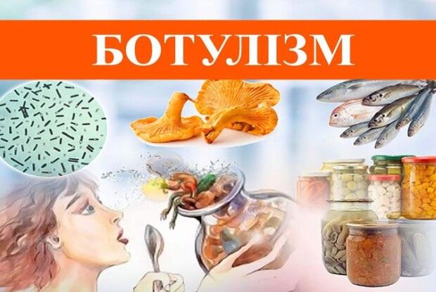 Обережно, БОТУЛІЗМ